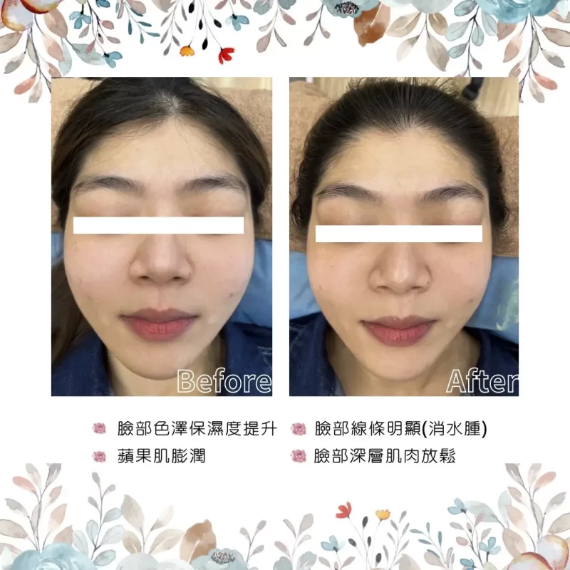 【台中美睫推薦】SBS睡美人美學,單根嫁接,專業6D,NUNU睫毛管理,臉部撥筋按摩-作品集-臉部撥筋-4