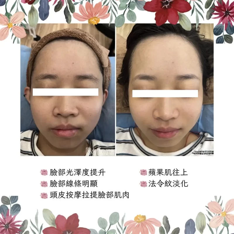 【台中美睫推薦】SBS睡美人美學,單根嫁接,專業6D,NUNU睫毛管理,臉部撥筋按摩-作品集-臉部撥筋-6